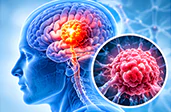Neuro Oncology